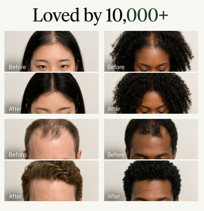 Korean Scalp Revival Bar